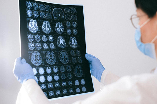 La enfermedad de Parkinson: ¿Qué tan preparada está Venezuela para atender a los pacientes que la padecen?