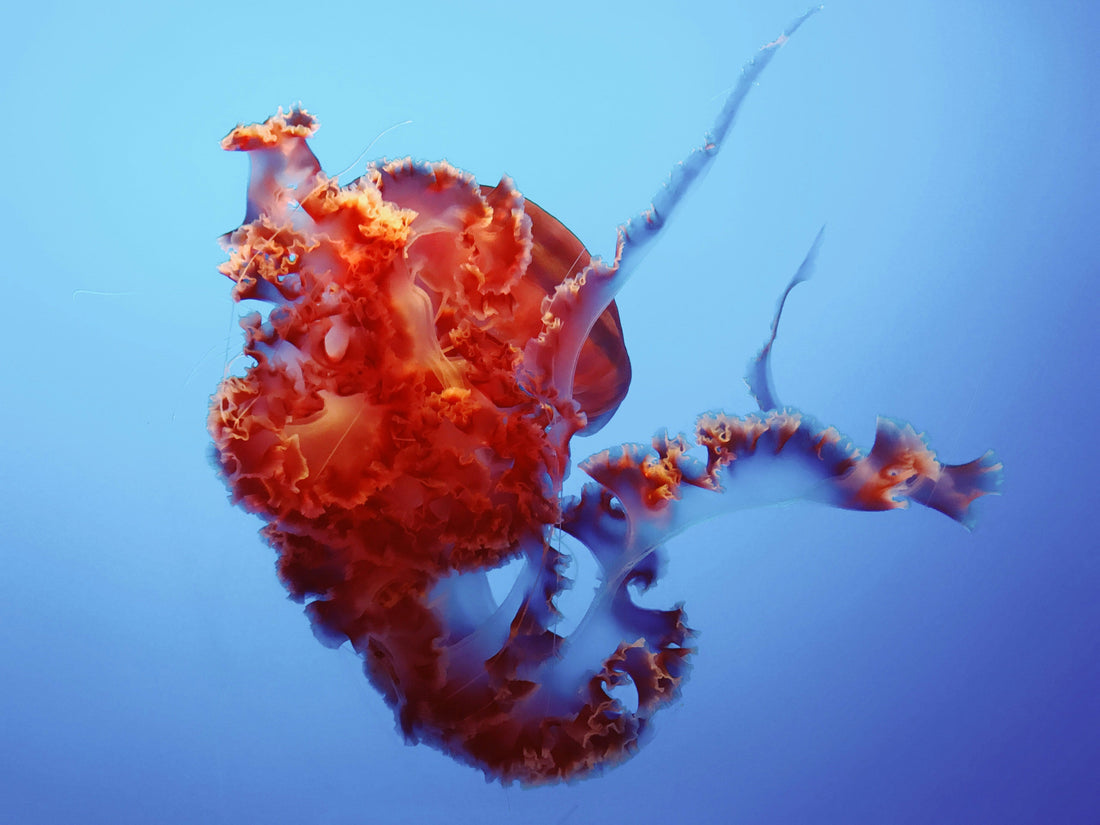 Mieloma múltiple: Lo que debes saber sobre este cáncer de la médula ósea