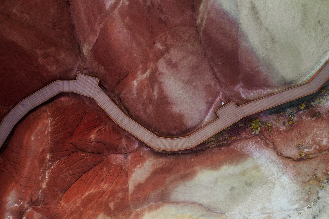 Fístula arteriovenosa nativa: su autopista natural para diálisis sin tubos plásticos