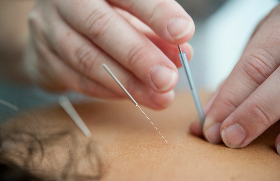 Terapias integrativas paliativas: acupuntura + morfina vencen dolor rebelde