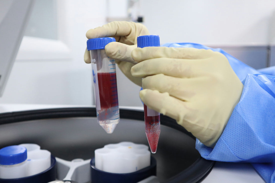 Avances en Diagnóstico Molecular en Hematología