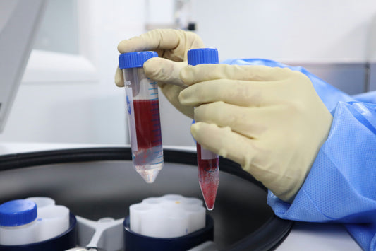 Avances en Diagnóstico Molecular en Hematología