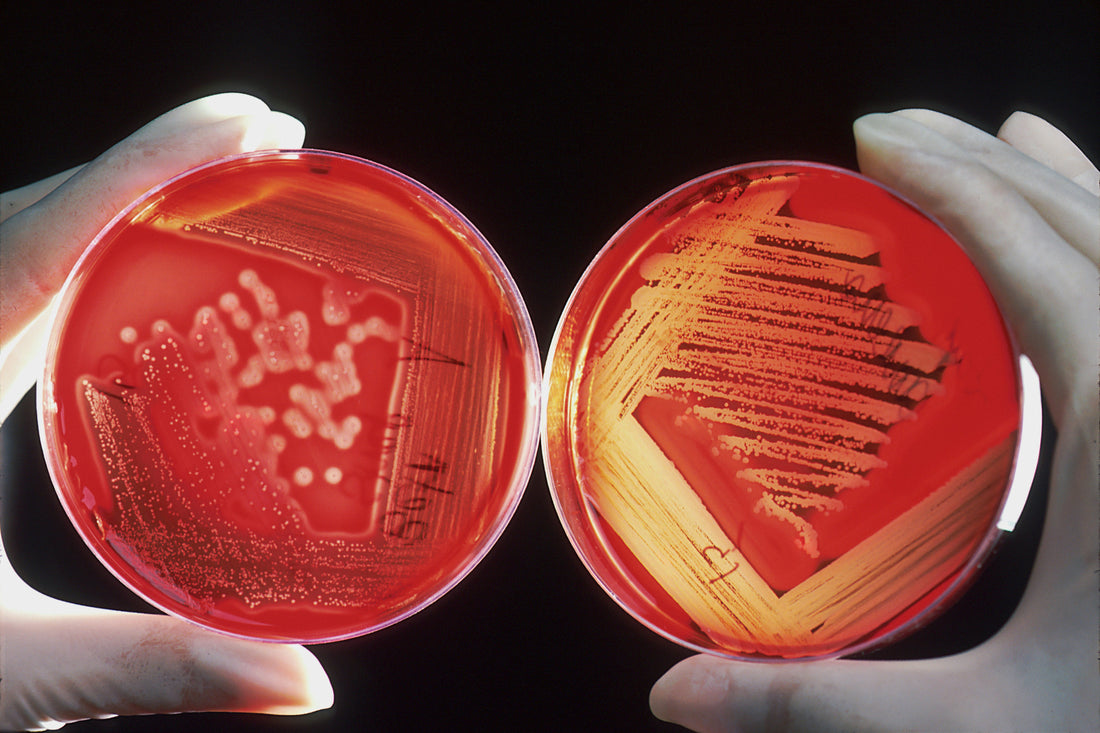 Resistencia a los antibióticos: un reto para todos