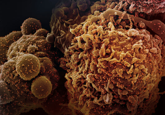 Leucemia linfoblástica aguda (LLA) en jóvenes: inmunoterapia reemplaza quimioterapia intensa