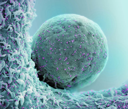 Actualización terapéutica en una neoplasia frecuente: cáncer colorrectal