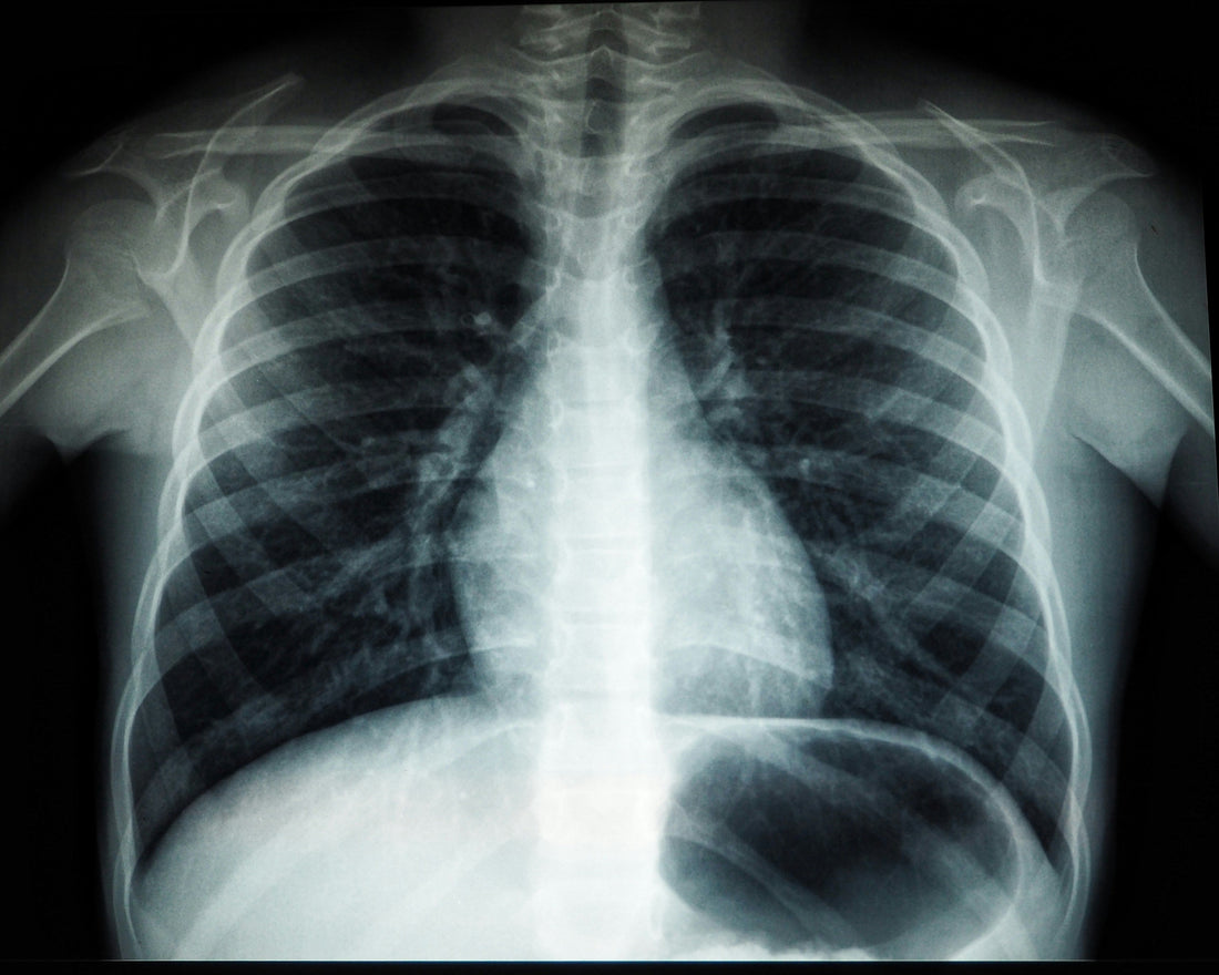 Cuidado de síntomas respiratorios en medicina paliativa