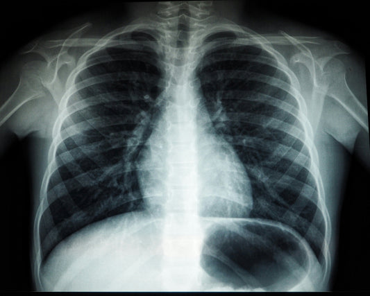 Cuidado de síntomas respiratorios en medicina paliativa