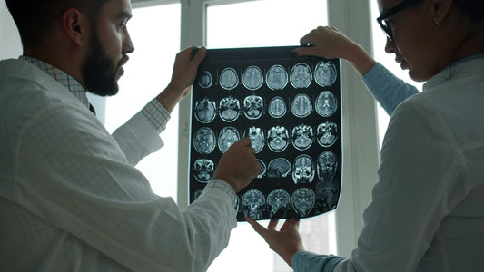 Actualización en el manejo temprano de la epilepsia