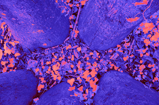 Nuevas guías en una enfermedad rara: amiloidosis AL de cadenas ligeras